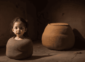 إنجاز طبي عالمي: أول عملية زراعة مثانة ناجحة في التاريخ