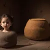 إنجاز طبي عالمي: أول عملية زراعة مثانة ناجحة في التاريخ